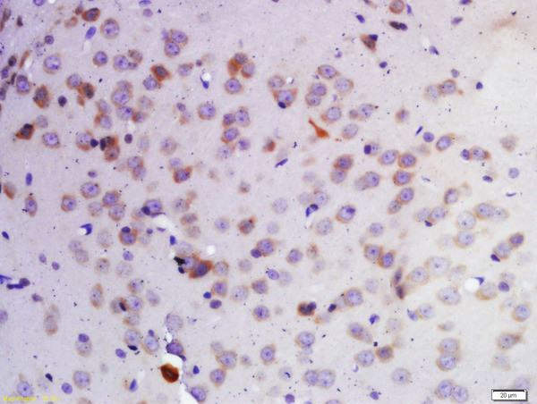 KDM1A Antibody in Immunohistochemistry (Paraffin) (IHC (P))