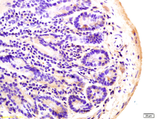 ADCY8 Antibody in Immunohistochemistry (Paraffin) (IHC (P))