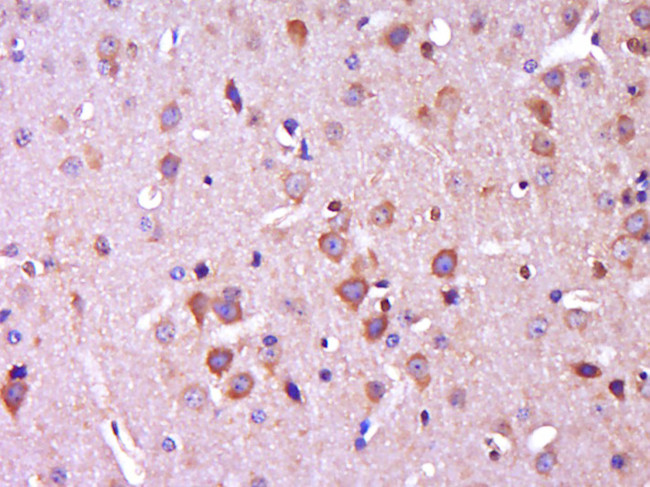 CTNNBIP1 Antibody in Immunohistochemistry (Paraffin) (IHC (P))