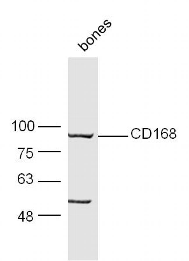 CD168 Antibody in Western Blot (WB)