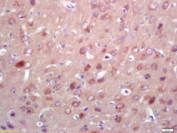 PNPO Antibody in Immunohistochemistry (Paraffin) (IHC (P))