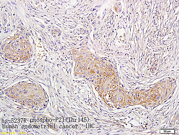 Phospho-CDKN1A (Thr145) Antibody in Immunohistochemistry (Paraffin) (IHC (P))