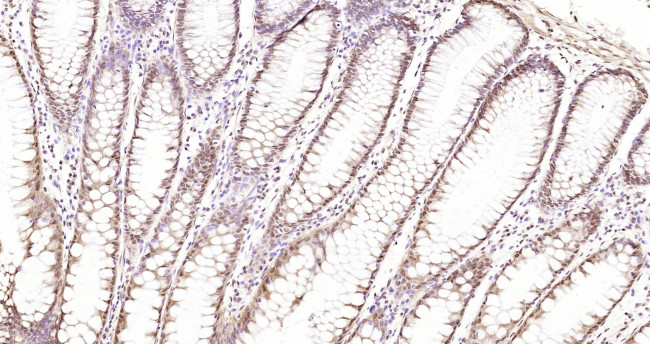 Phospho-CDKN1A (Thr145) Antibody in Immunohistochemistry (Paraffin) (IHC (P))