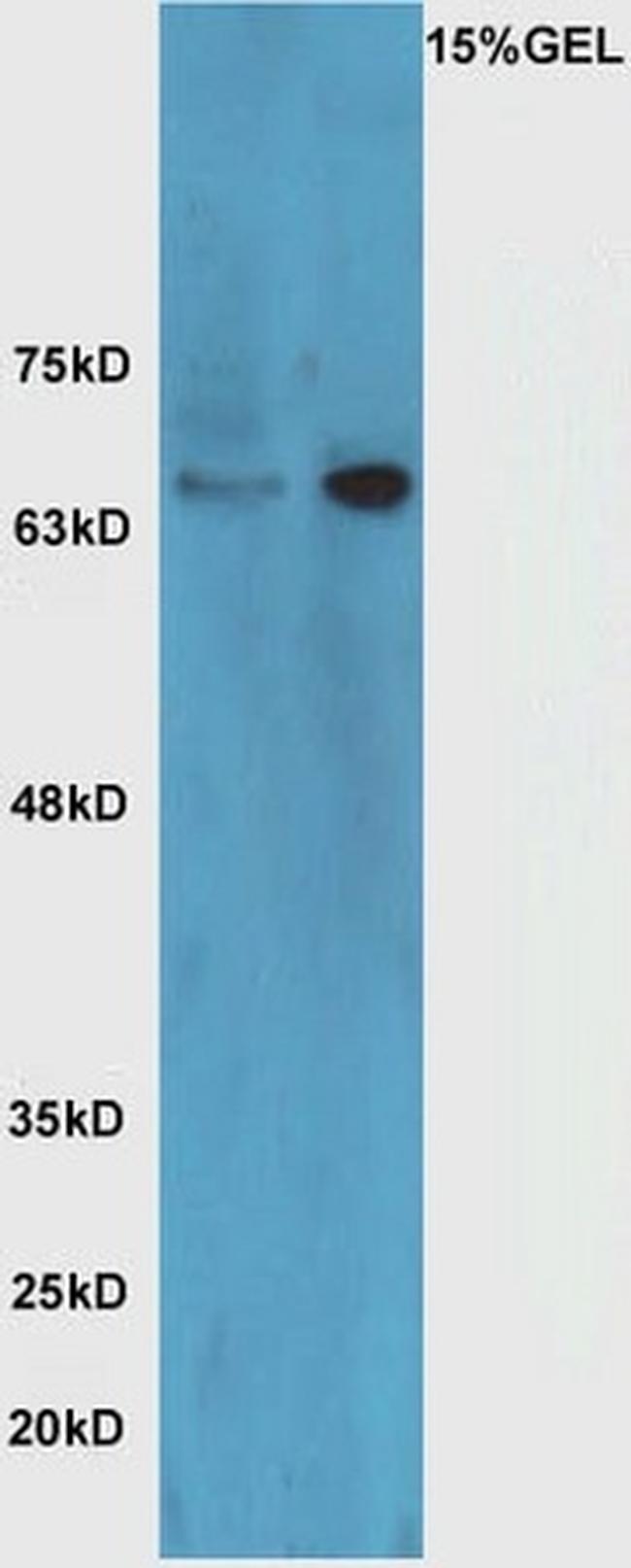 HRG beta 1 Antibody in Western Blot (WB)