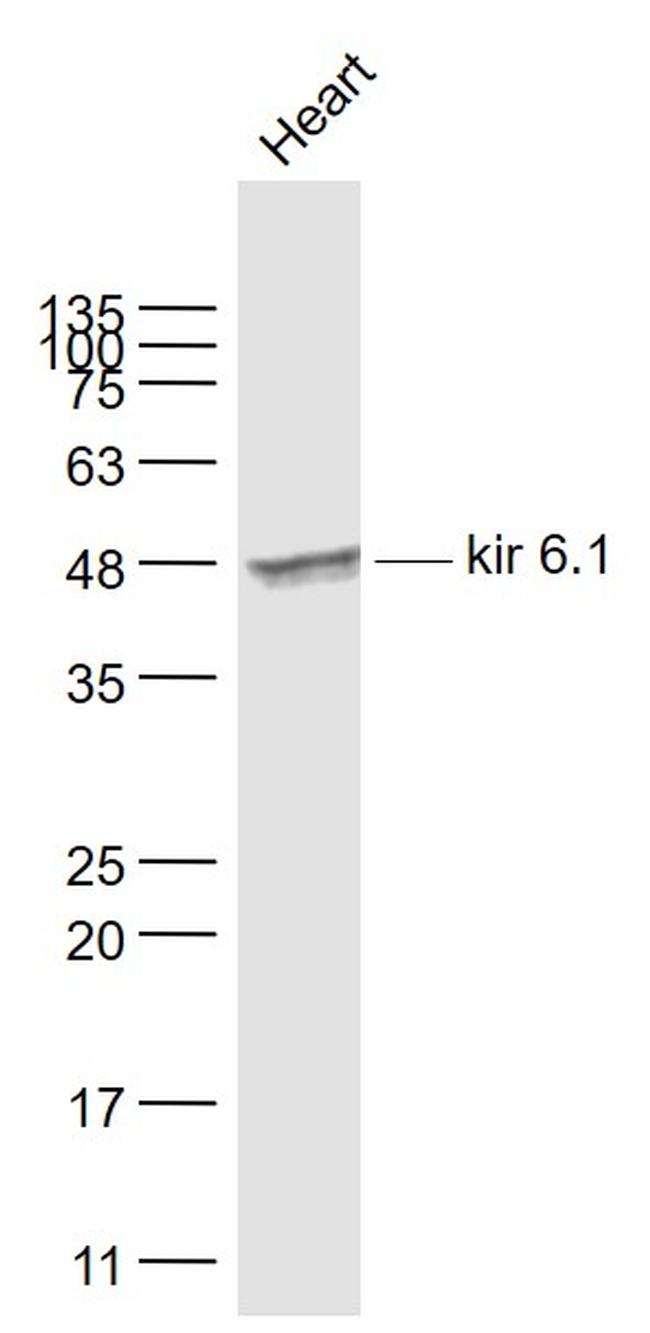 kir 6.1 Antibody in Western Blot (WB)