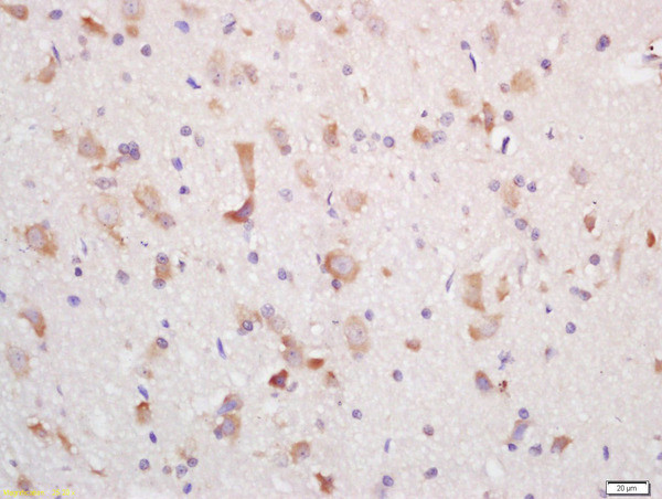 MCHR Antibody in Immunohistochemistry (Paraffin) (IHC (P))