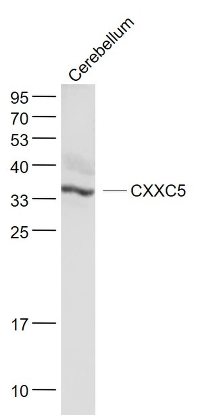 CXXC5 Antibody in Western Blot (WB)