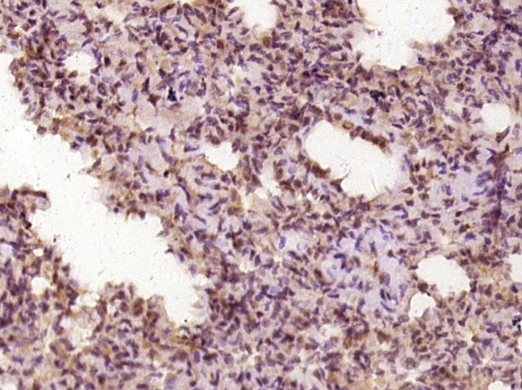 DNA polymerase delta Antibody in Immunohistochemistry (Paraffin) (IHC (P))