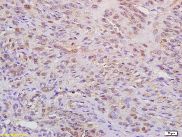 WAPL Antibody in Immunohistochemistry (Paraffin) (IHC (P))