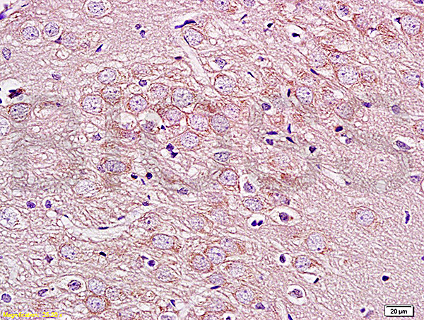 GPRIN1 Antibody in Immunohistochemistry (Paraffin) (IHC (P))