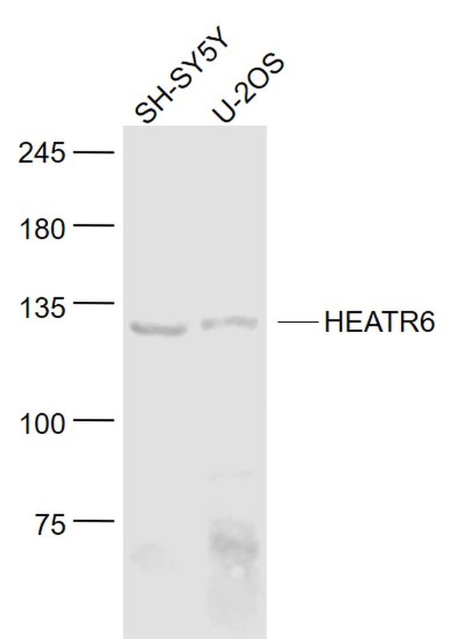 HEATR6 Antibody in Western Blot (WB)