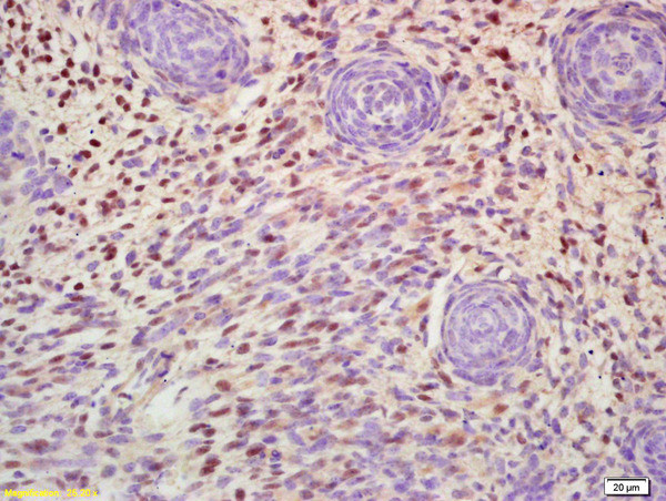 MSX1 Antibody in Immunohistochemistry (Paraffin) (IHC (P))