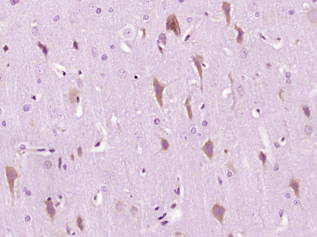 IRE1a Antibody in Immunohistochemistry (Paraffin) (IHC (P))