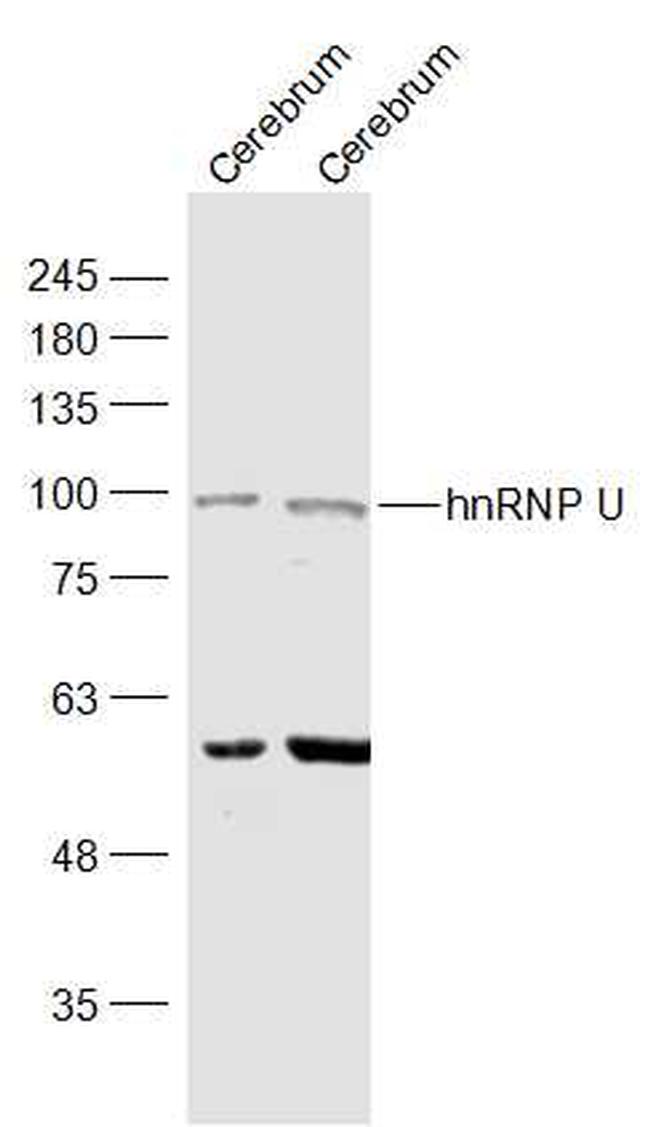 hnRNP U Antibody in Western Blot (WB)