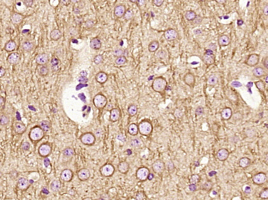 Beta tubulin Antibody in Immunohistochemistry (Paraffin) (IHC (P))