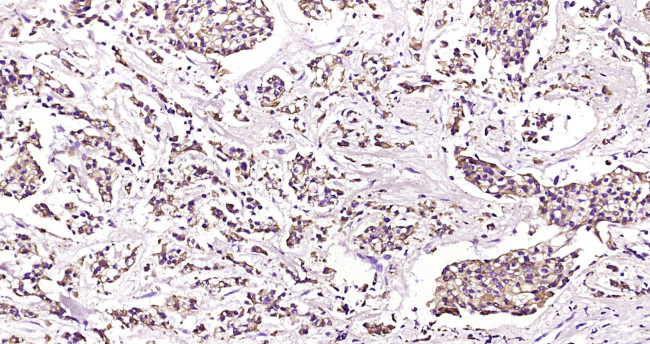 CK18 Antibody in Immunohistochemistry (Paraffin) (IHC (P))