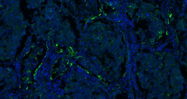 CK18 Antibody in Immunohistochemistry (Paraffin) (IHC (P))