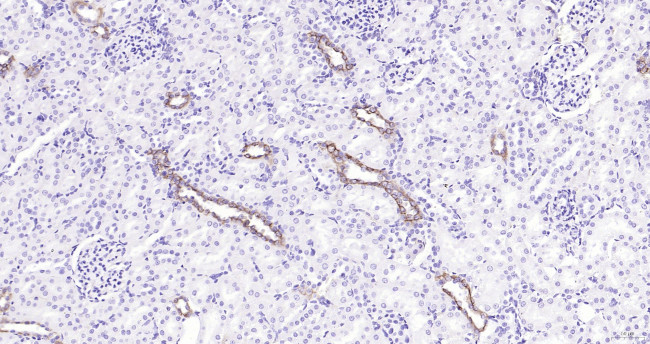 CK18 Antibody in Immunohistochemistry (Paraffin) (IHC (P))