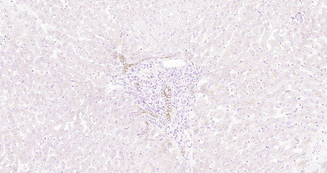 CK18 Antibody in Immunohistochemistry (Paraffin) (IHC (P))