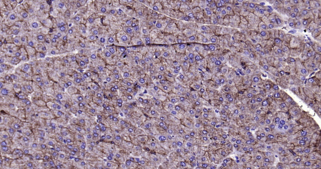 CK18 Antibody in Immunohistochemistry (Paraffin) (IHC (P))