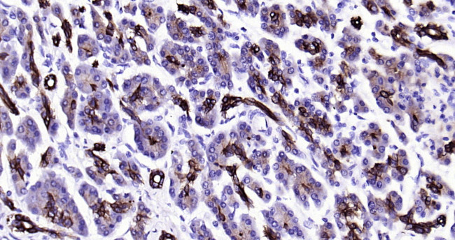 CK18 Antibody in Immunohistochemistry (Paraffin) (IHC (P))