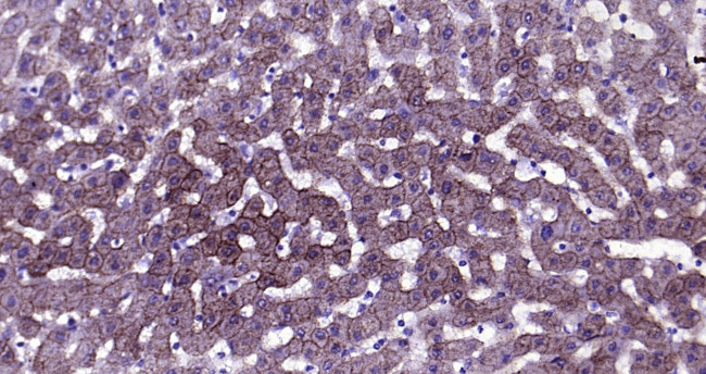 CK18 Antibody in Immunohistochemistry (Paraffin) (IHC (P))