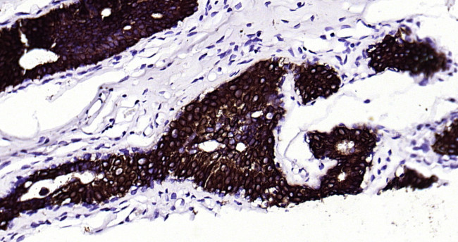 CK18 Antibody in Immunohistochemistry (Paraffin) (IHC (P))