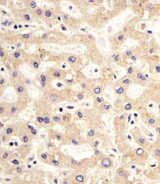 PDK2 Antibody in Immunohistochemistry (Paraffin) (IHC (P))