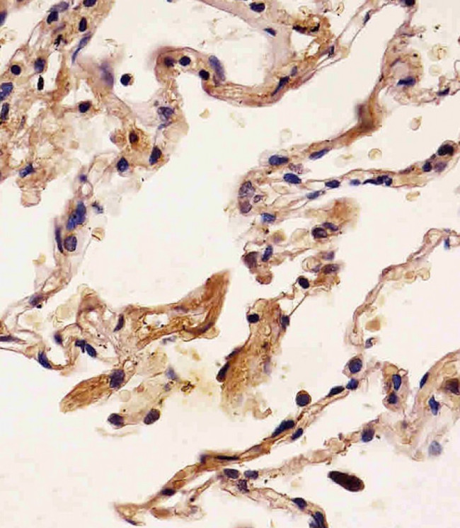 S100A2 Antibody in Immunohistochemistry (Paraffin) (IHC (P))