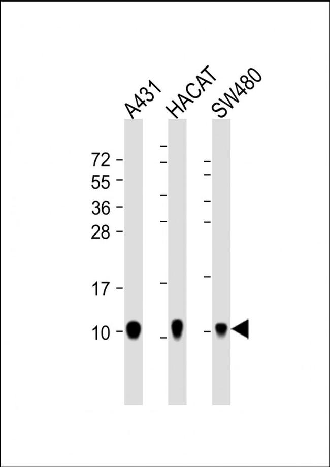 S100A2 Antibody in Western Blot (WB)