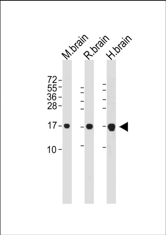 LC3 Antibody in Western Blot (WB)
