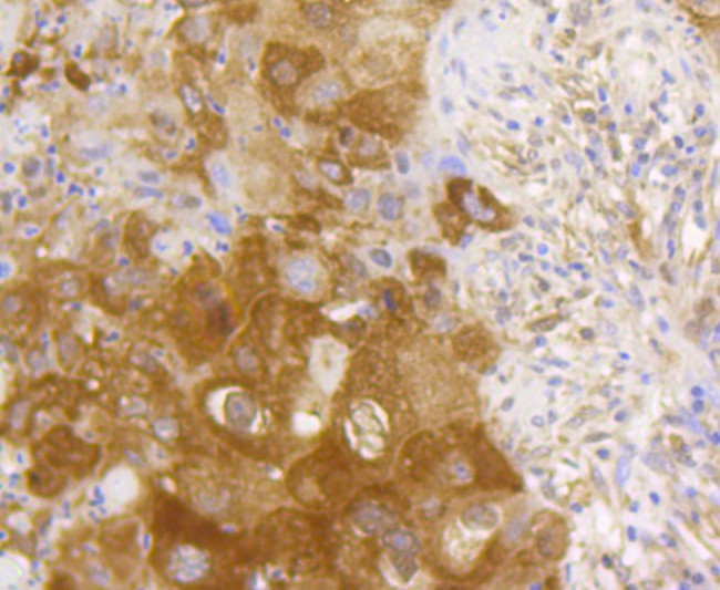 NF-kB p65 Antibody in Immunohistochemistry (Paraffin) (IHC (P))