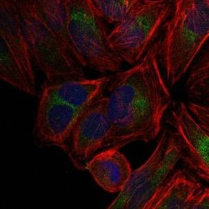 c-Jun Antibody in Immunocytochemistry (ICC/IF)