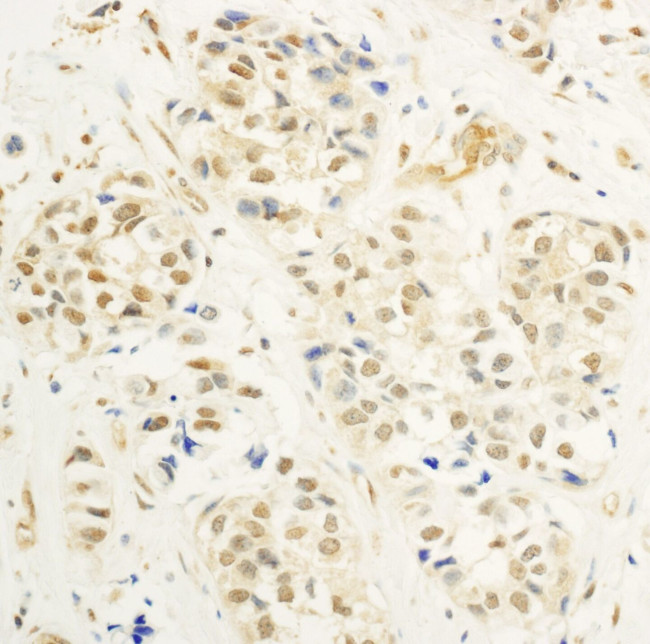 c-Myb Antibody in Immunohistochemistry (IHC)