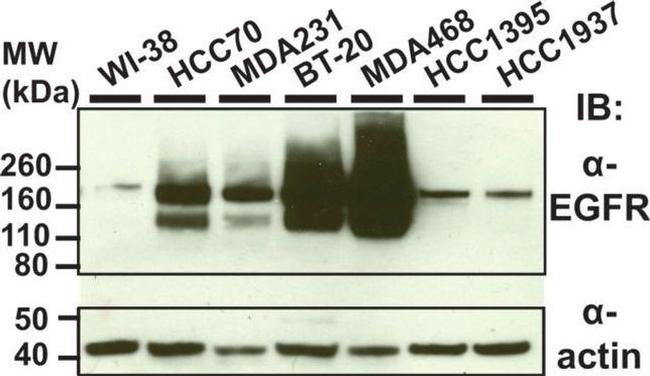 EGFR Antibody in Western Blot (WB)