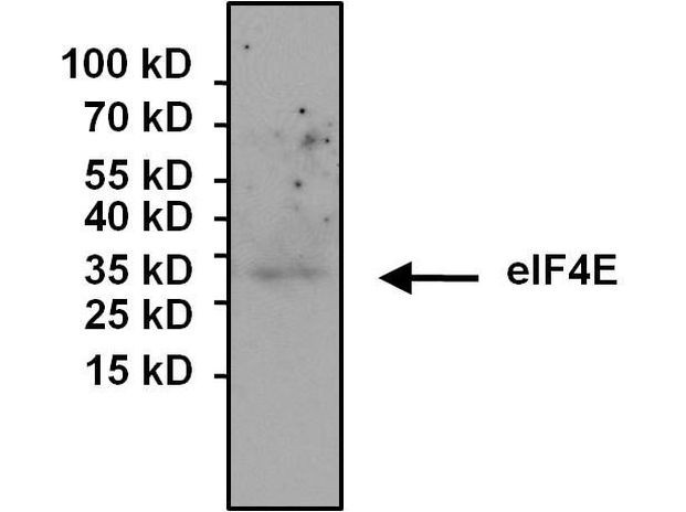 eIF4E Antibody in Immunoprecipitation (IP)