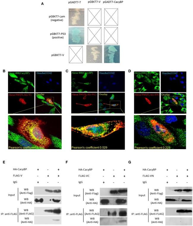 DYKDDDDK Tag Antibody in Western Blot, Immunoprecipitation (WB, IP)