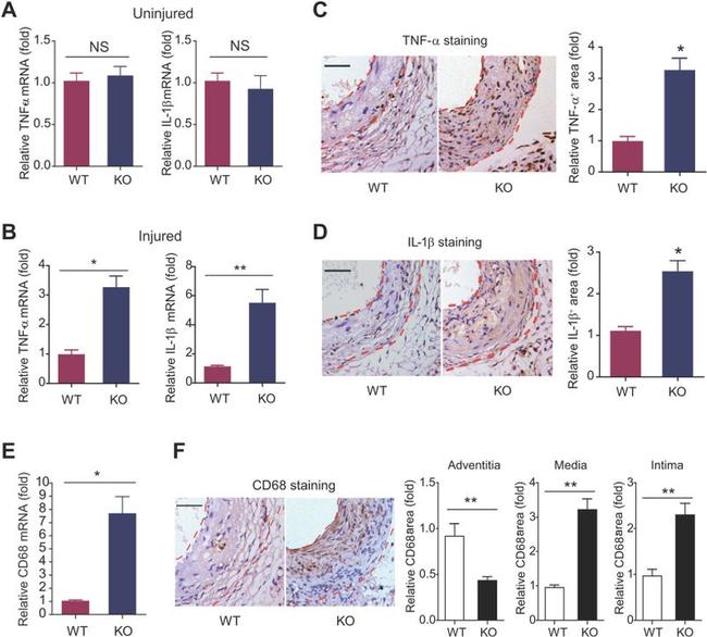 CD68 Antibody in Immunohistochemistry (IHC)