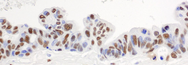 hnRNP-H Antibody in Immunohistochemistry (IHC)