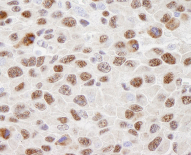 hnRNP-U Antibody in Immunohistochemistry (IHC)