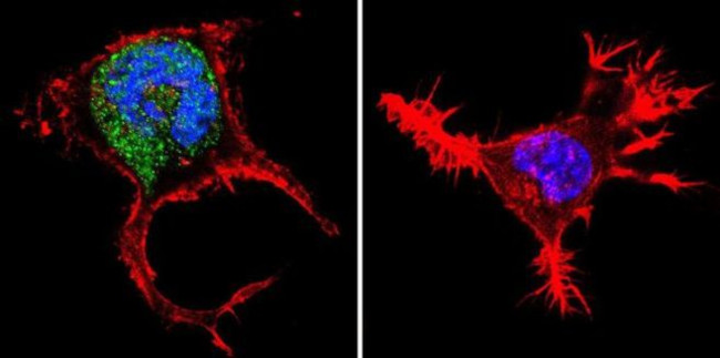 iNOS Antibody in Immunocytochemistry (ICC/IF)