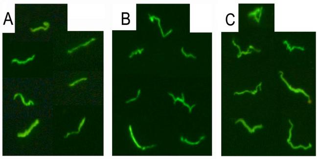 Borrelia burgdorferi Antibody in Immunocytochemistry (ICC/IF)