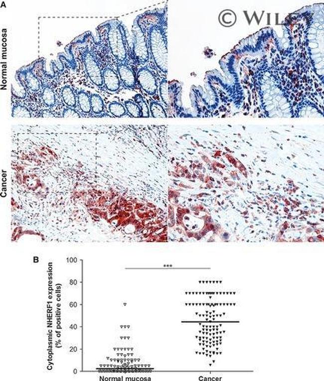 EBP50 Antibody in Immunohistochemistry (Paraffin) (IHC (P))