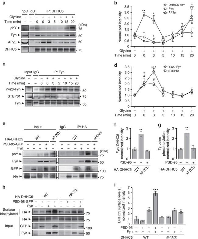 AP2M1 Antibody in Western Blot (WB)