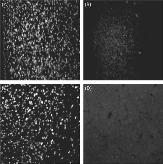 CBP Antibody in Immunohistochemistry (IHC)