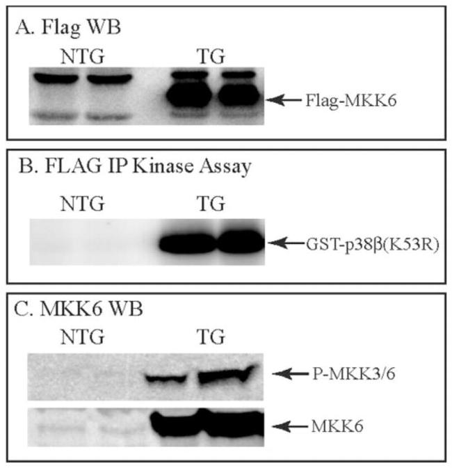 p38 MAPK beta Antibody in Western Blot (WB)