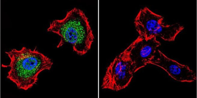 p23 Antibody in Immunocytochemistry (ICC/IF)