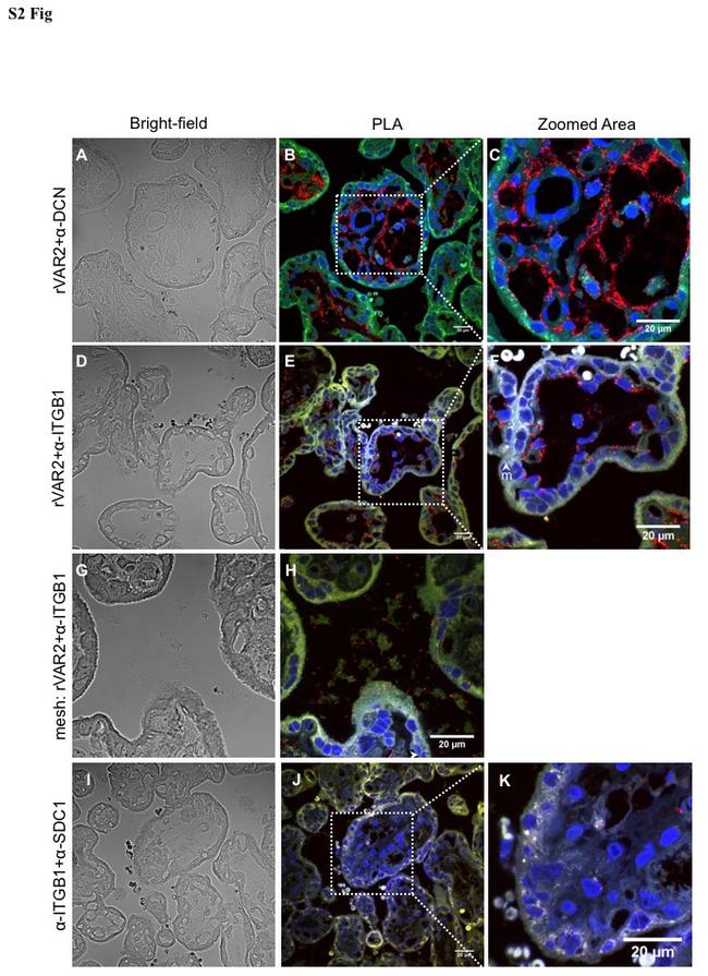 Decorin Antibody in Immunohistochemistry (Paraffin) (IHC (P))