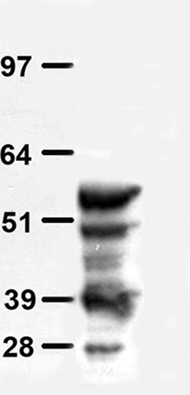 tdTomato Antibody in Western Blot (WB)