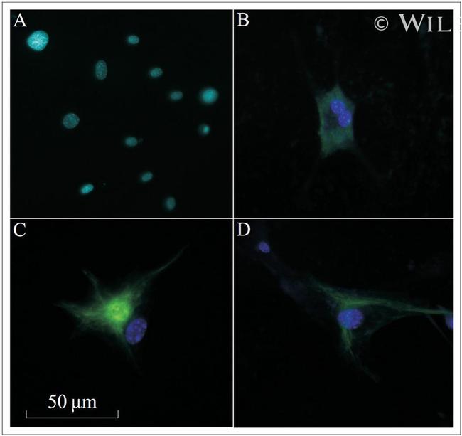 NEFL Antibody in Immunocytochemistry (ICC/IF)